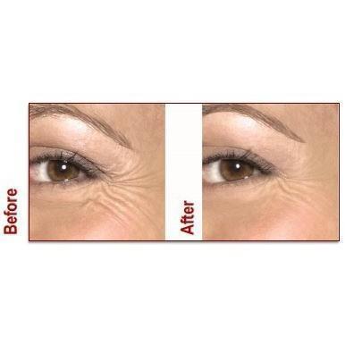 France Laure - Myo-Lift Serum - #shop_name - #product_vendor